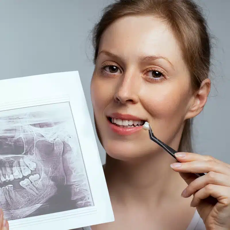 Woman examines dental x-ray of dental crowns with tooth model