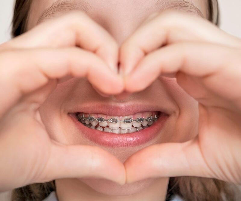 Hands forming a heart around a smile with metal braces, as patients weigh cosmetic dental treatments in La Mesa, CA