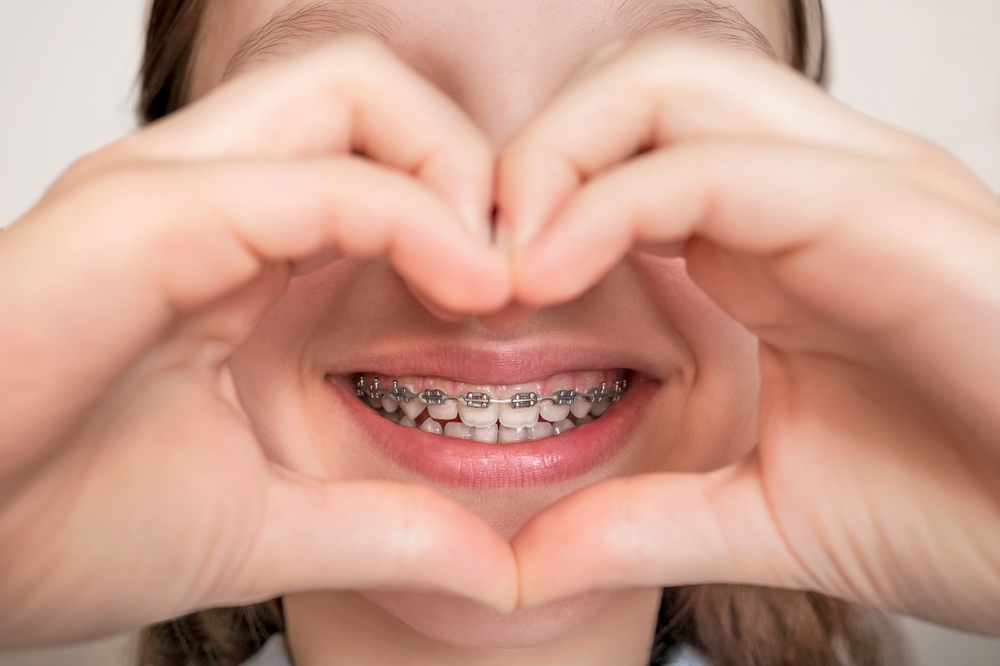 Hands forming a heart around a smile with metal braces, as patients weigh cosmetic dental treatments in La Mesa, CA