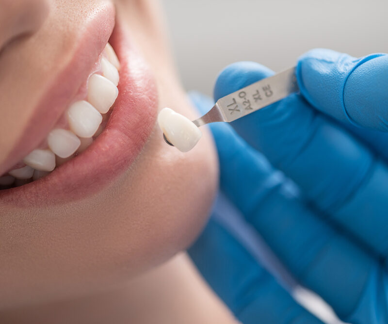 Gloved hand holding a tooth shade tab beside a woman's smile, illustrating color matching for dental crowns in La Mesa, CA