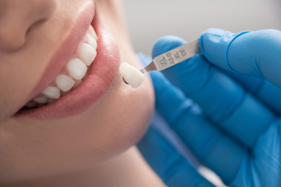 Gloved hand holding a tooth shade tab beside a woman's smile, illustrating color matching for dental crowns in La Mesa, CA